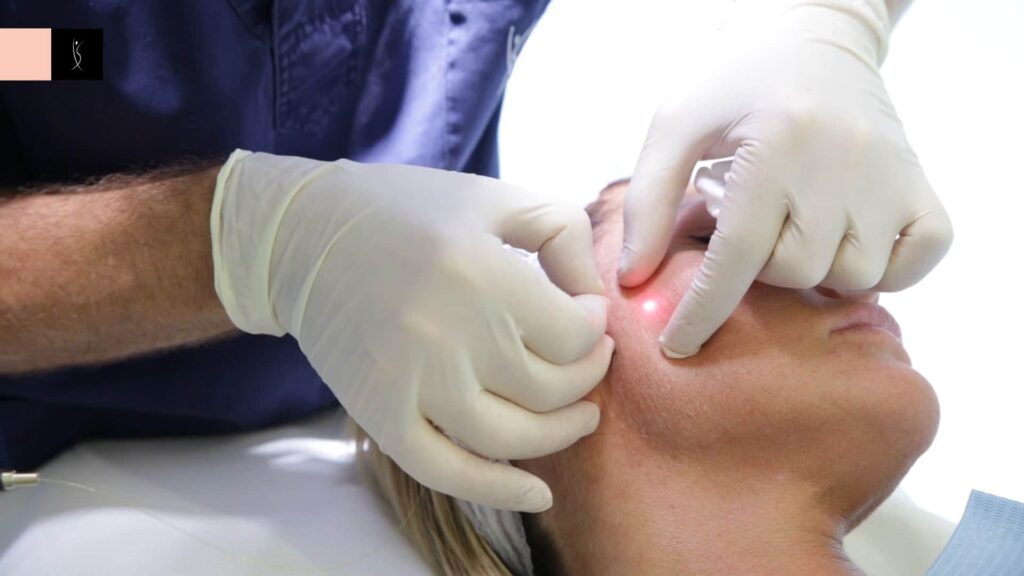 Choosing Laser Treatments in Dubai: Advice from Leading Specialists